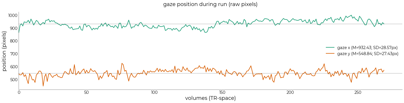 ../_images/examples_eyetracker_15_1.png